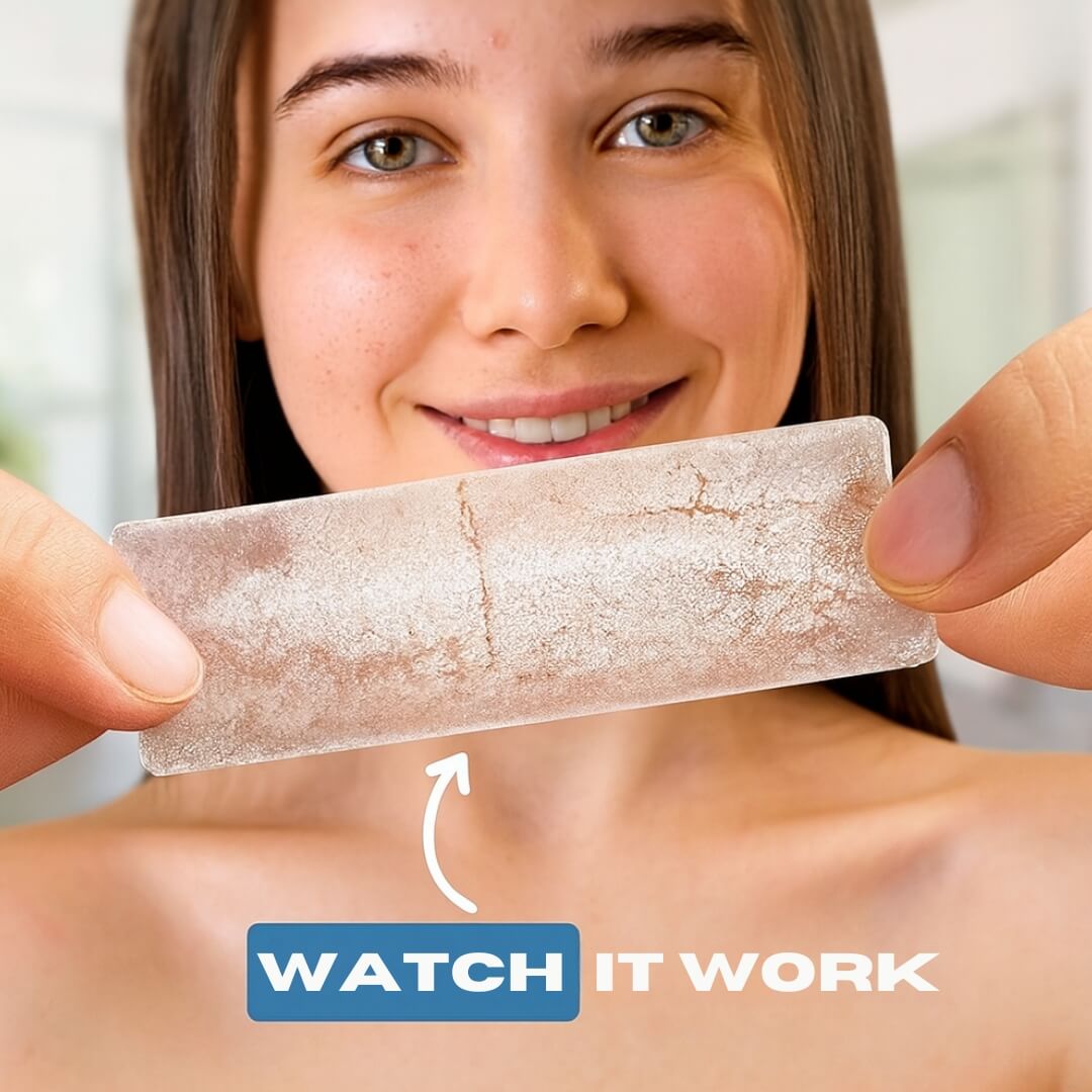 DermTape – Hydrocolloid Acne & Scarring Tape Roll